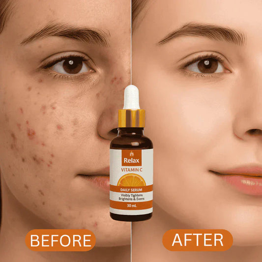 PREMIUM QUALITY RELAX VITAMIN C SERUM For Smooth Your Skin in Winter ( 59% OFF ) Huge Offer