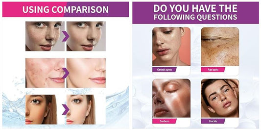 Spots Fading Urea 100% Removal