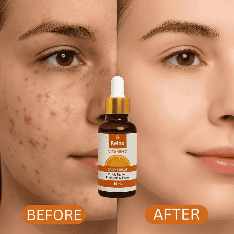 PREMIUM QUALITY RELAX VITAMIN C SERUM  For Smooth Your Skin in Winter ( 59% OFF ) Huge Offer